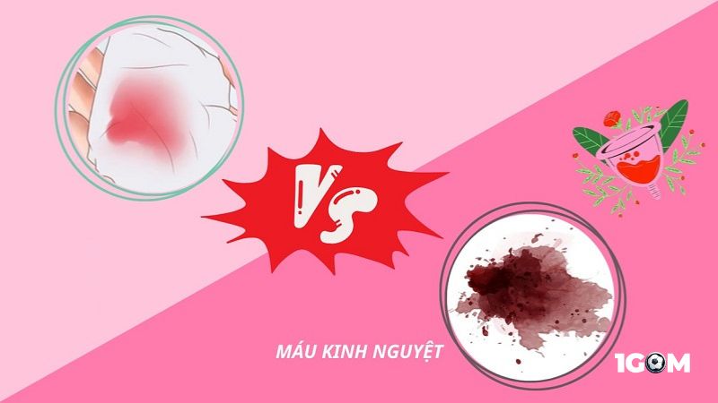 Mộng mị thấy máu kinh nguyệt báo hiệu điềm tốt hay điềm xấu?