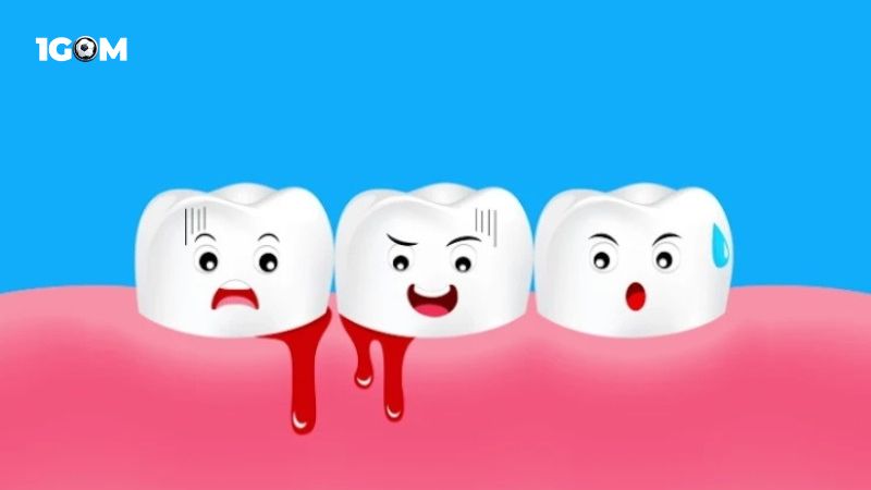 Ngủ mơ thấy rụng nhiều răng bị chảy máu